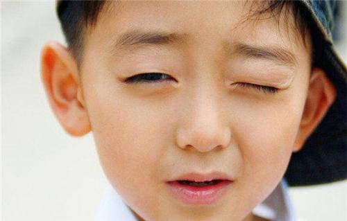 孩子频繁眨眼怎么回事？是抽动症吗？ 