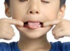 <b>小孩频繁清嗓子有可能是抽动症</b>